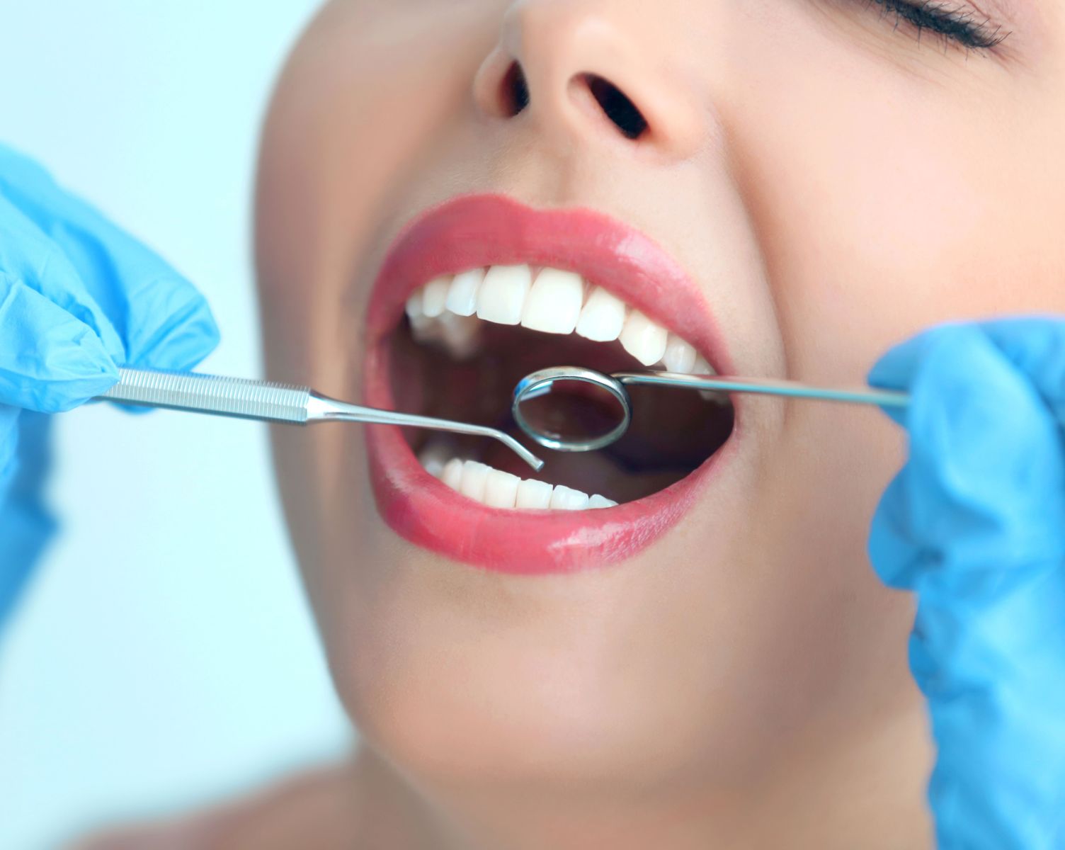 Woman with beautiful teeth at dentist 